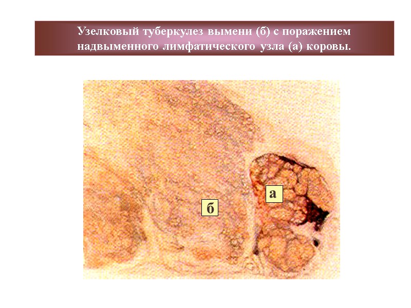 Узелковый туберкулез вымени (б) с поражением надвыменного лимфатического узла (а) коровы. а б